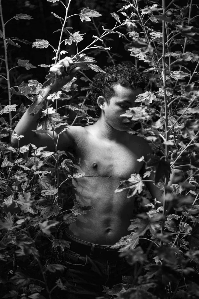A black and white conceptual fine art portrait of DANNY for the ESTRANGED series by ARJAN SPANNENBURG, featuring a person with top surgery scars among tall plants.